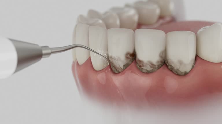 Trusted Root Canal Treatment service in La Paloma, TX - Dentist Open Now